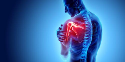 Douleurs à l’épaule – Causes et thérapies