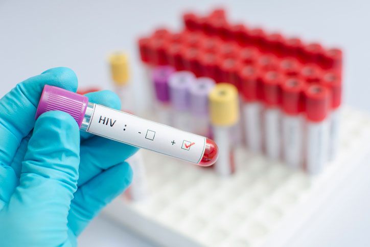 VIH vers un nouveau traitement hebdomadaire